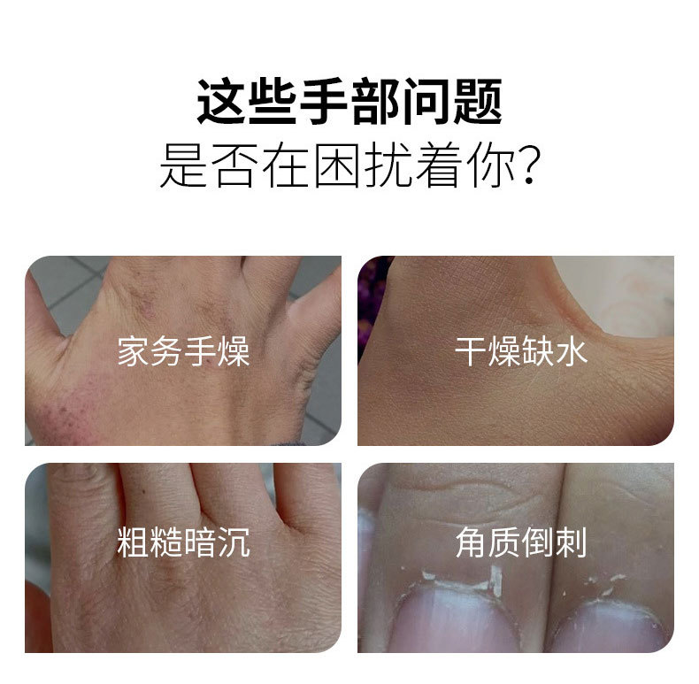 護手霜幫您解決手部以下問題 護手霜幫您解決手部以下問題